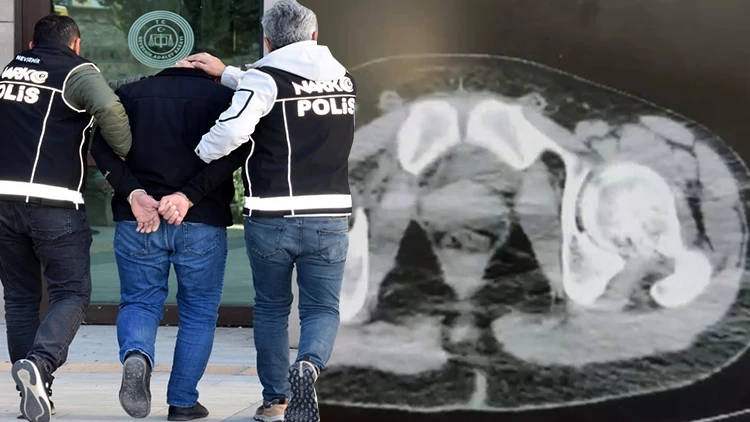 Nevşehir’de Uyuşturucu Operasyonu Midelerinden 101 Kapsül Metamfetamin Çıktı