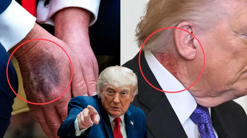 Beyaz Saray Trump’ın Sağlık Raporunu Paylaştı