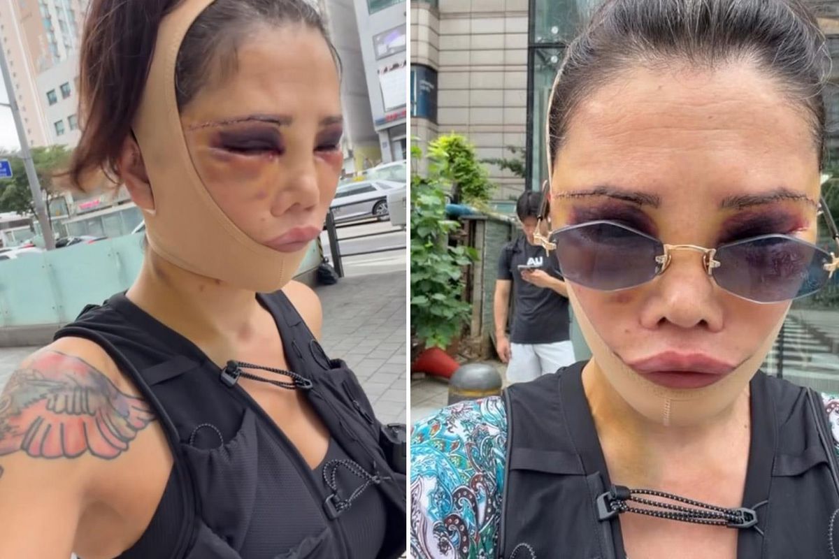 Didem Ceran Son Halini Paylaştı! Estetik Eleştirilerine Sert Yanıt Verdi