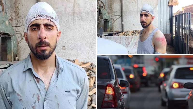 Şanlıurfa’da Trafikte Akılalmaz Saldırı: Yavaş Giden Sürücünün Burnunu Kırdılar